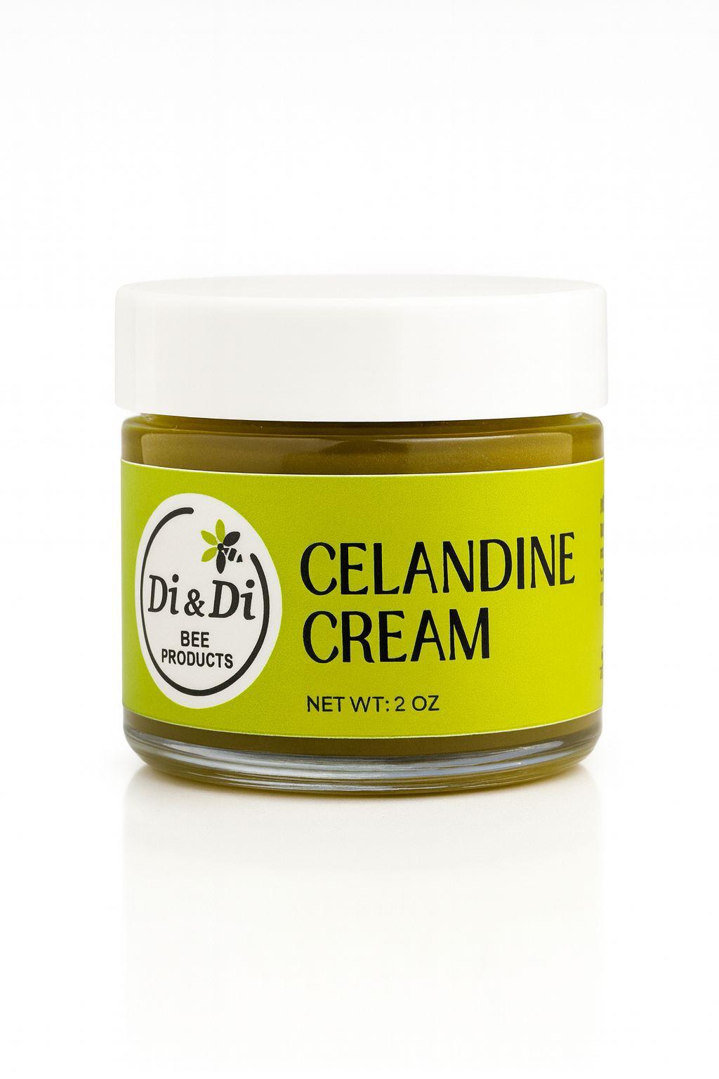 Celandine Cream